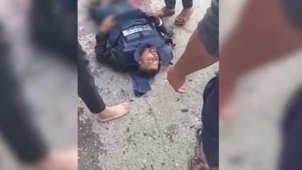 İsrail Al Jazeera muhabiri ile bir kameramanı ağır yaraladı! UMED: Bu barbarlık