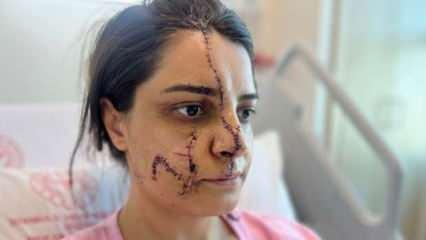 Marmaray’da saldırıya uğrayan kadın yüzündeki 40 dikişle dehşet dolu anları anlattı 