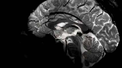 Dünyanın en büyük MRI cihazıyla çekildi: İnsan beyni ilk kez bu kadar net görüntülendi...