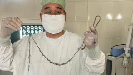 Hastanede akıllara durgunluk veren olay! Kırgızistanlı çocuğun beyninden saç çıktı