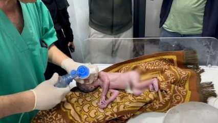  İsrail askerlerince öldürülen Filistinli hamile kadının bebeğini doktorlar kurtardı