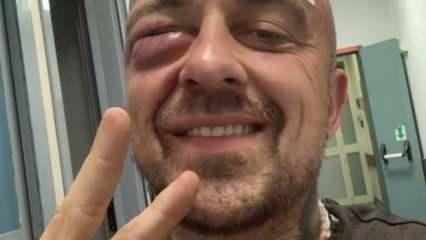 Filistin destek&ccedil;isi İtalyan şef Rubini siyonistlerin saldırısına uğradı