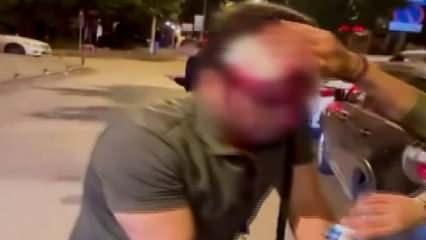 Ankara'da yolcularla taksici arasında kısa mesafe kavgası: 4 yaralı!