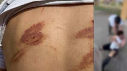 'Karısını dövüyor' iddiasıyla dayak yiyen adamın eşinden beklenmedik açıklama 