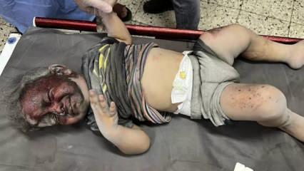 Gazze’nin merkezinde İsrail vahşeti! Şehit ve yaralılara ulaşamıyor