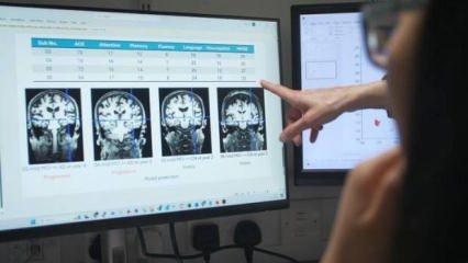 Alzheimer'a karşı mücadelede oyunun kurallarını değiştirecek!