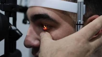 Gözlerde hasar bırakan virüse dikkat! Tedavi edilmezse ömür boyu izi kalıyor