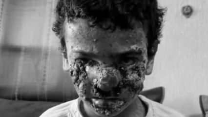 Gazzeli çocuğun yüzünü İsrail böyle yaptı!