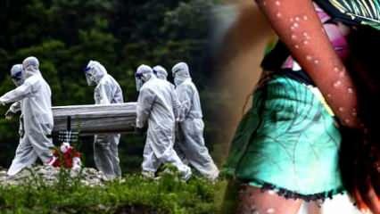Uzmanlar açıkladı! Maymun çiçeği virüsünden korunmanın tek yolu! Dünya tehlikenin eşiğinde