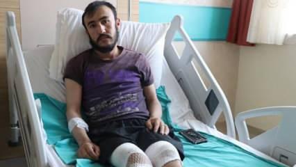 Yıldırım isabet eden çobanın bacakları cilt nakli ve cerrahi müdahaleyle kurtarıldı