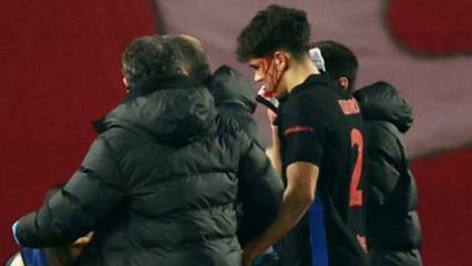 Devler Ligi'nde korkutan anlar! Genç yıldız kanlar içinde kaldı