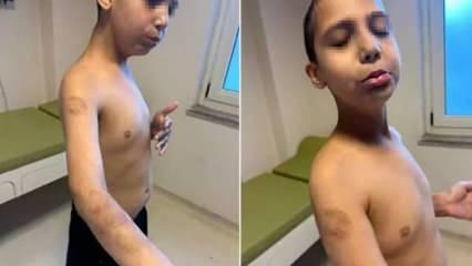 Beylikdüzü'nde 9 yaşındaki otizmli çocuğa dayak! Bakanlık soruşturma başlattı