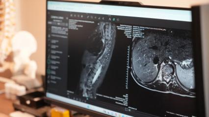 Anneler dikkat! Bu hastalığı ilk siz fark ediyorsunuz