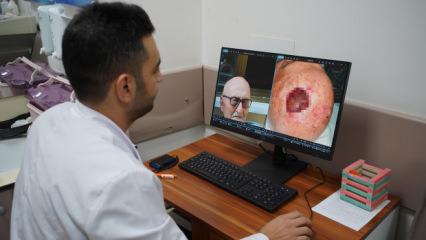 Literat&uuml;re ge&ccedil;en nadir vaka d&uuml;nyada 3'&uuml;nc&uuml; kez g&ouml;r&uuml;ld&uuml;