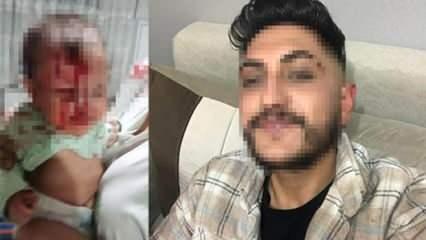 Ankara'da 4 aylık bebeği cam sehpaya fırlatan baba hakkında karar!