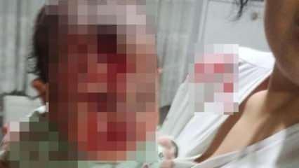 Ankara'da baba dehşeti: 4 aylık bebeğini cam sehpaya fırlattı!