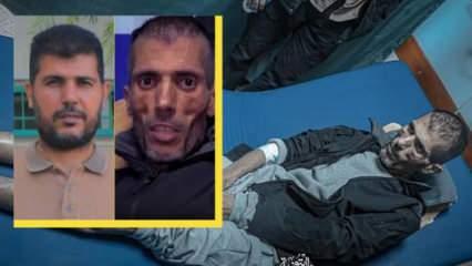 Serbest bırakılan Filistinli anlattı: 45 gün boyunca gözlerim bağlı ve kelepçeliydim