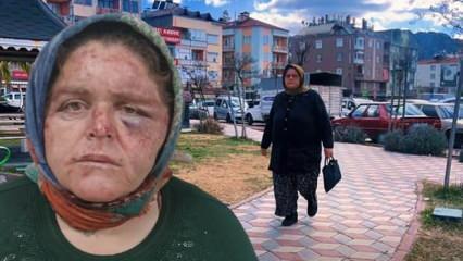 Oğlu dehşeti yaşattı: 'Tokat yemekten yüzüm tanınmaz hale geldi'