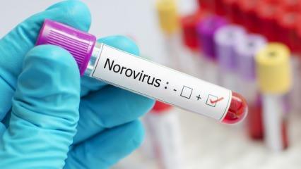 Uzmanından Norovirüs uyarısı! Bu belirtilerle karşılaşıyorsanız doktorun yolunu tutun