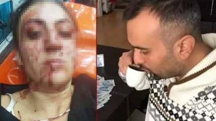 Sinem'i 7 yerinden bıçaklayan eski eşine verilen cezanın gerekçesi 'pes' dedirtti 