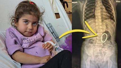 Hepsi 4 yaşındaki Rumeysa'nın bağırsağından çıktı: Doktorlar şoke oldu! Tam 24 tane...