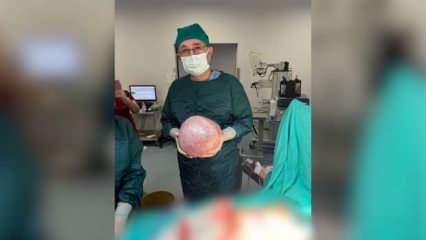 Karın ağrısı şikayetiyle gitti! Rahminden 7 kiloluk tümör çıktı