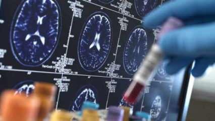 Bu kan testi her şeyi değiştirecek: Alzheimer artık erken evrede tespit edilebiliyor!