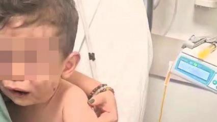 Denizli’de vahşet! 2 yaşındaki Aren bebeği yakmaya çalıştılar