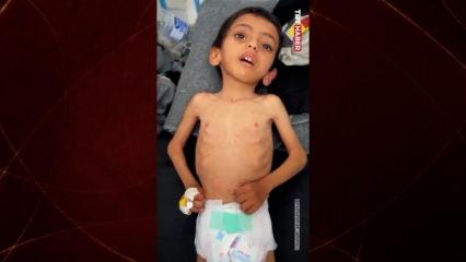 Gazze'de binlerce çocuk açlıktan ölüyor!İşte son örnek Ebu Hüseyin