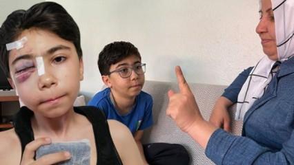 13 yaşındaki çocuk geçirdiği kazanın ardından çift görmeye başladı