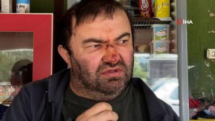 Bolu’da yüzde 90 engelli Murat Kepil akrabası tarafından darp edildi iddiası