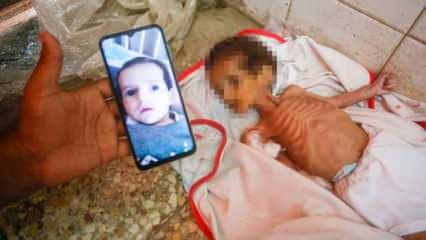 İsrail ablukası altındaki Gazze'de 3 aylık bebek Curi de açlıktan öldü