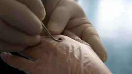 Tokat'ta 3'ü çocuk, 5 kişi KKKA hastalığı teşhisiyle tedavi görüyor