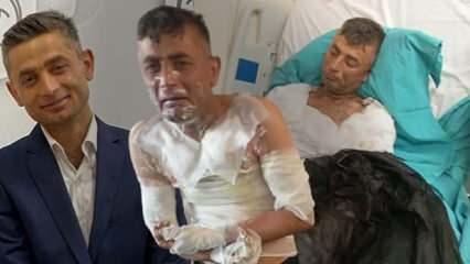 Engelli vatandaşın üzerine benzin dökerek yaktı: Olayın her detay kan dondurdu...