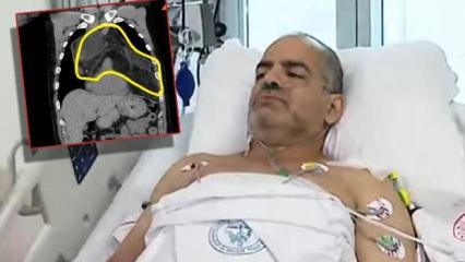 Meyve se&ccedil;erken nefesi kesildi, hastalığını duyunca şoke oldu! T&uuml;rkiye'de bilinen ilk vaka!