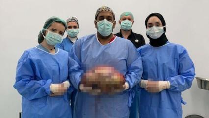 Şişlik yüzünden gittiği hastanede karnından 10 kilogram ağırlığında kitle çıkarıldı 