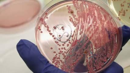 "Et yiyen bakteri" alarmı: Açık yaradan vücuda giriyor!