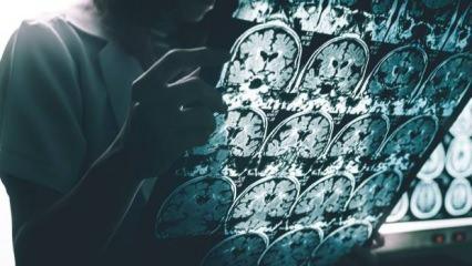 Harvard’dan çığır açan buluş: Alzheimer’a karşı lityum umudu