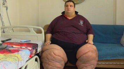 İllet hastalık iki yıl önce başladı! 270 kiloya ulaşan Mehmet, 15 aydır evden çıkamıyor