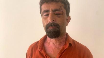 Damat dehşeti: Kayınpederini öldüresiye dövdü! 