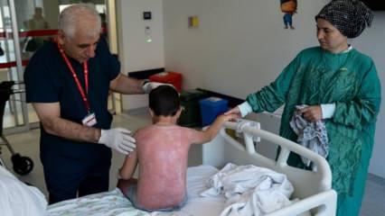 Tatilleri kâbusa döndü! 4 saat güneşte kalan çocuk, hastanelik oldu