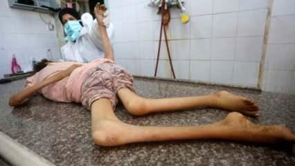 Gazze'den kahreden haber: Bir günde 339 kişi şehit düştü