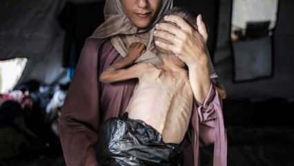 Son dakika: Gazze'den korkunç haber geldi! Durum felaket bir hal aldı...