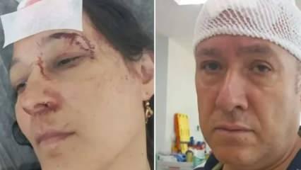 Tatilde kabusu yaşadılar! Demir sopalarla dövülüp hastanelik oldular