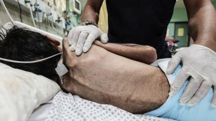 Gazze'de açlıktan ölenlerin sayısı 404'e yükseldi
