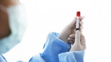 Sepsis her yıl 11 milyon insanı öldürüyor: İşte belirtiler ve korunma yolları