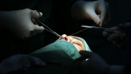 Merdiven altı estetik ve dövme İşlemlerine karşı uzman uyarısı