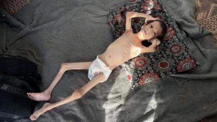10 yaşındaki Gazzeli Nafız 4 aylık bebeğe dönüştü: Annesi taşımaya bile korkuyor