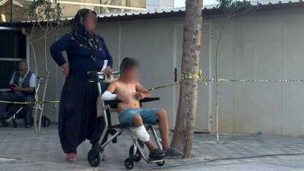 Adıyaman'da başıboş köpeğin saldırdığı çocuk yaralandı