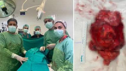 2.5 milyonda bir görülüyor, tam 1,1 kg!